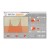 FabFilter Total Bundle